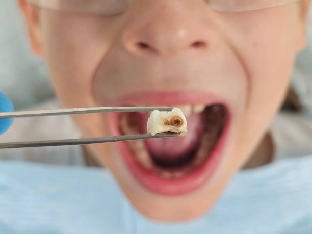 Best Pediatric Emergency Dentist in Le Claire, IA